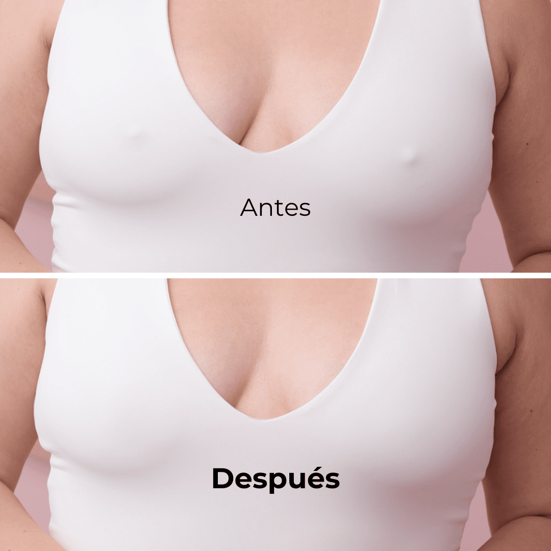 Pezoneras Triángulos sin Adhesivo - Curviva